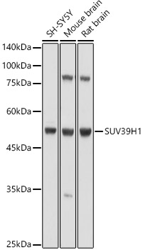 SUV39H1 Rabbit Polyclonal Antibody