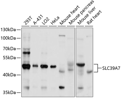 SLC39A7 Rabbit Polyclonal Antibody