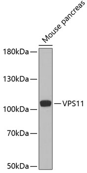 VPS11 Rabbit Polyclonal Antibody