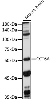 CCT6A Rabbit Polyclonal Antibody