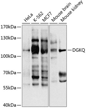 DGKQ Rabbit Polyclonal Antibody