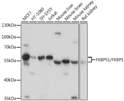 FKBP5 Rabbit Polyclonal Antibody