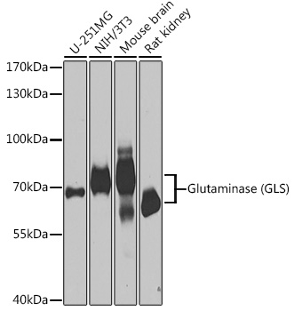 GLS Rabbit Polyclonal Antibody
