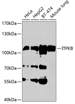 ITPKB Rabbit Polyclonal Antibody