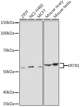 KRT81 Rabbit Polyclonal Antibody