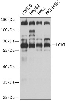 LCAT Rabbit Polyclonal Antibody