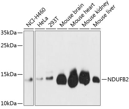 NDUFB2 Rabbit Polyclonal Antibody