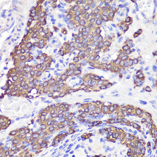UBL3 Rabbit Polyclonal Antibody