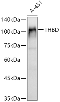 THBD Rabbit Polyclonal Antibody