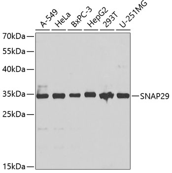 SNAP29 Rabbit Polyclonal Antibody