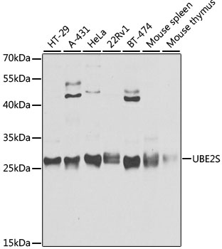 UBE2S Rabbit Polyclonal Antibody