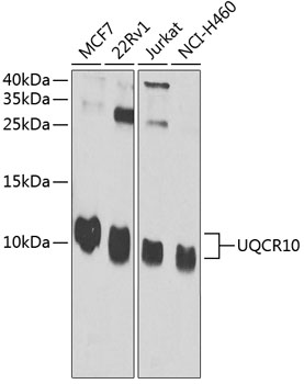 UQCR10 Rabbit Polyclonal Antibody