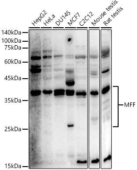 MFF Rabbit Polyclonal Antibody