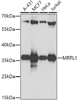 MRPL1 Rabbit Polyclonal Antibody