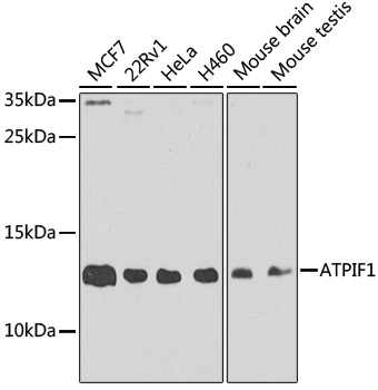 ATPIF1 Rabbit Polyclonal Antibody