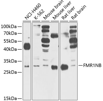FMR1NB Rabbit Polyclonal Antibody