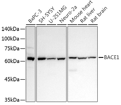 BACE1 Rabbit Polyclonal Antibody