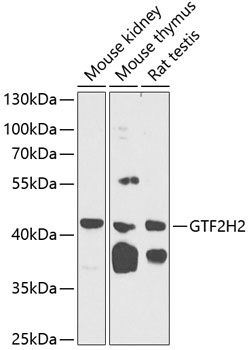 GTF2H2 Rabbit Polyclonal Antibody