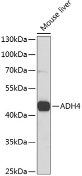 ADH4 Rabbit Polyclonal Antibody