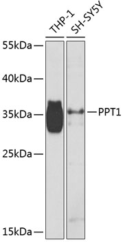PPT1 Rabbit Polyclonal Antibody