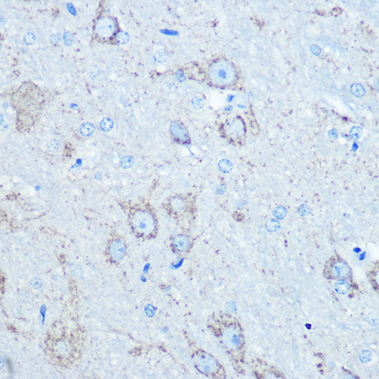 LC3B Rabbit Polyclonal Antibody