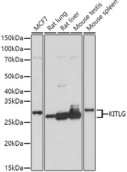 KITLG Rabbit Polyclonal Antibody