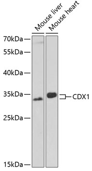 CDX1 Rabbit Polyclonal Antibody