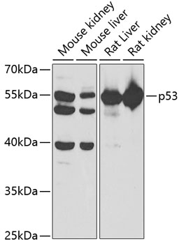 p53 Rabbit Polyclonal Antibody
