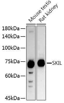 SKIL Rabbit Polyclonal Antibody