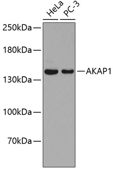 AKAP1 Rabbit Polyclonal Antibody