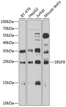 SFRS9 Rabbit Polyclonal Antibody
