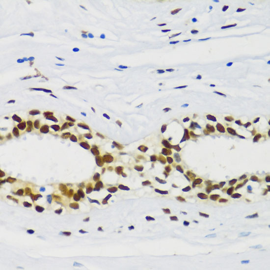 CIRBP Rabbit Polyclonal Antibody