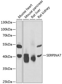 SERPINA7 Rabbit Polyclonal Antibody