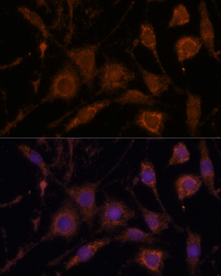 STC1 Rabbit Polyclonal Antibody