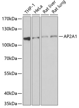 AP2A1 Rabbit Polyclonal Antibody