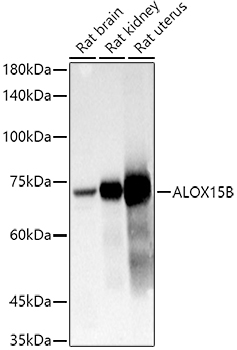 ALOX15B Rabbit Polyclonal Antibody