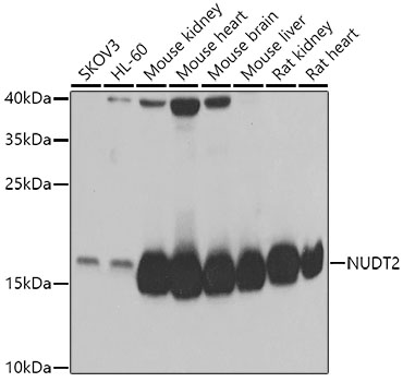 NUDT2 Rabbit Polyclonal Antibody