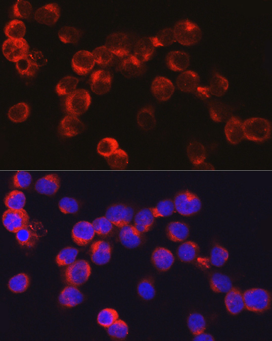 DEFA1 Rabbit Polyclonal Antibody