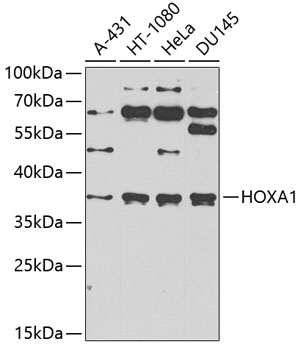 HOXA1 Rabbit Polyclonal Antibody