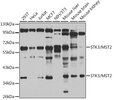 STK3 Rabbit Polyclonal Antibody