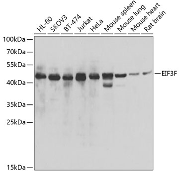 EIF3F Rabbit Polyclonal Antibody