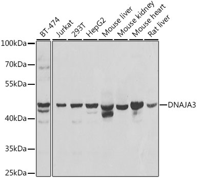 DNAJA3 Rabbit Polyclonal Antibody