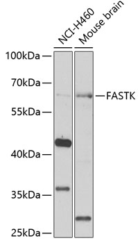 FASTK Rabbit Polyclonal Antibody