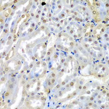 TUSC2 Rabbit Polyclonal Antibody
