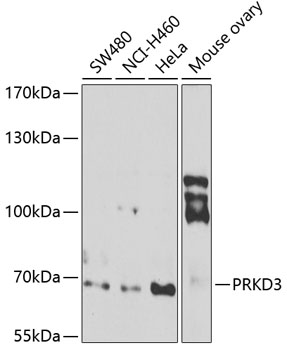 PRKD3 Rabbit Polyclonal Antibody