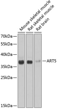 ART5 Rabbit Polyclonal Antibody