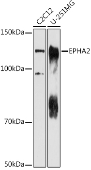 EPHA2 Rabbit Polyclonal Antibody
