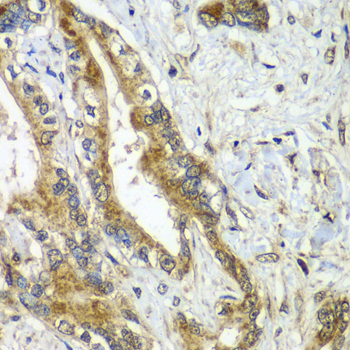 CDC16 Rabbit Polyclonal Antibody