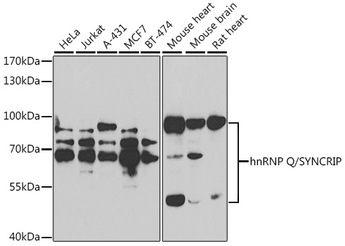 SYNCRIP Rabbit Polyclonal Antibody