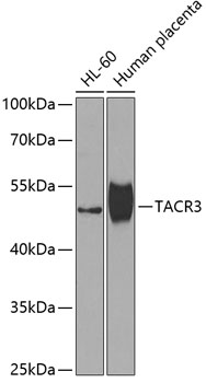 TACR3 Rabbit Polyclonal Antibody